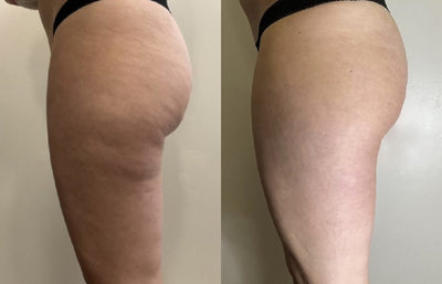 Recensionsbild från Elin N.